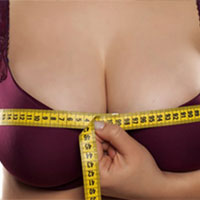 Breast Reduction